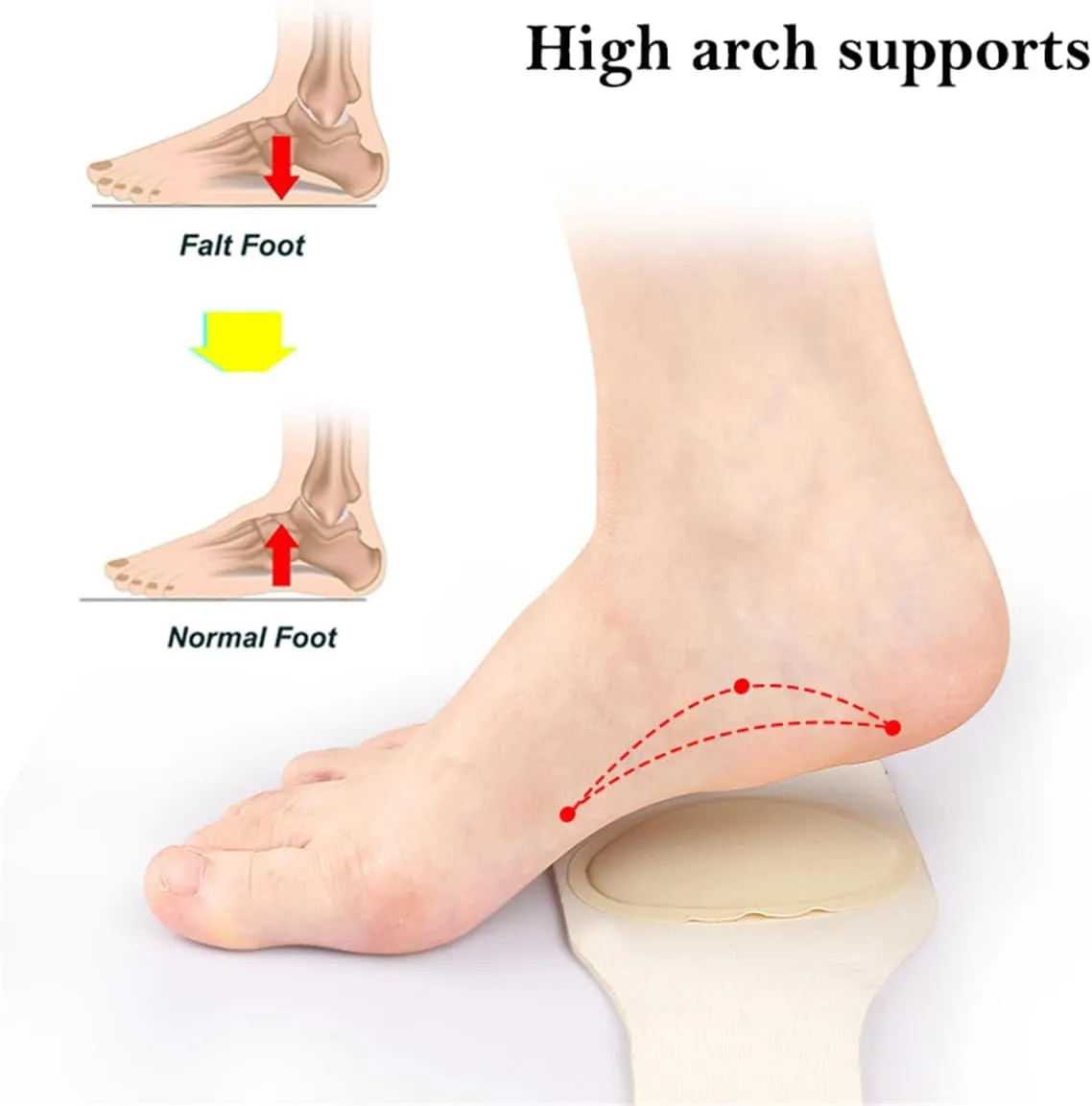 Arch Support Sleeves - Upgrade Adjustable Orthotic Wrap Compression Arch Support Brace with Gel Pad for Flat Feet & Plantar Fasciitis Pain Relief - Unisex - 1 Pair (Skin)